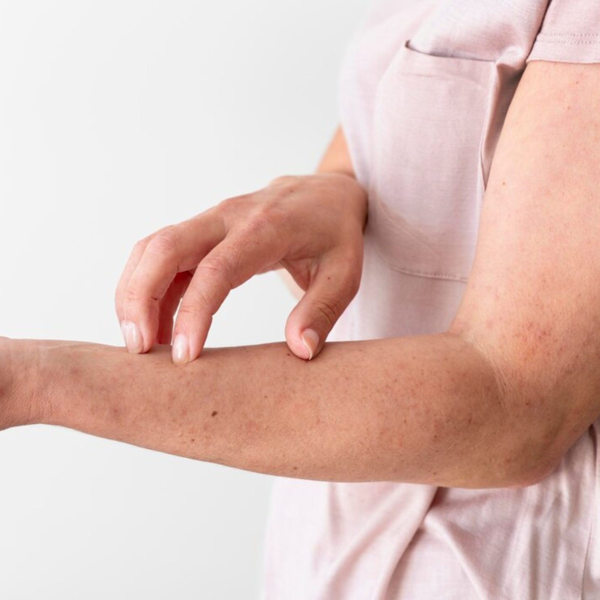 Paciente Alergología